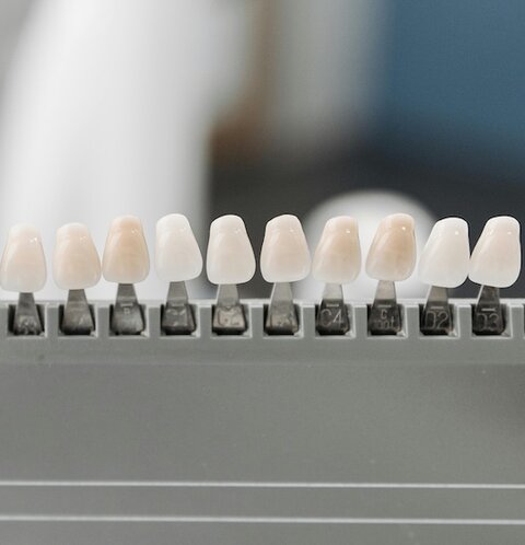 Prothetik & Zahnersatz